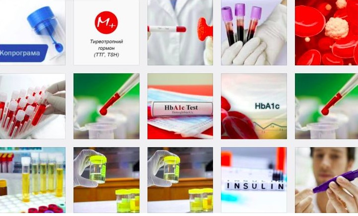 Здоров’я здебільшого в розумних аналізах: Роль компанії «Меді Лаб +» у забезпеченні якісних медичних досліджень