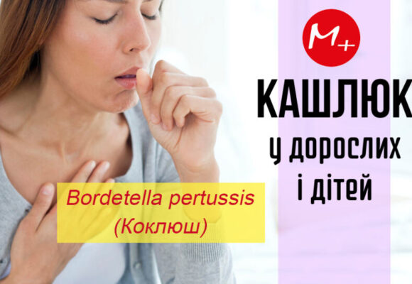 Аналіз medilab.km.ua: Перспективи виявлення інфекційної панепідемії через коклюш