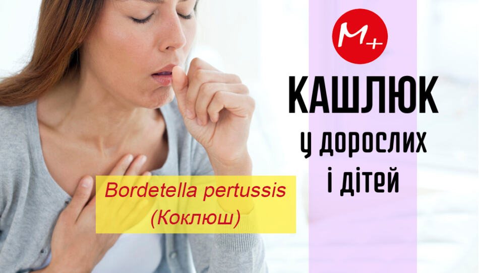 Аналізи medilab.km.ua: Важливість подального моніторингу кашлюка через IgM